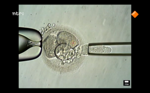 embryo